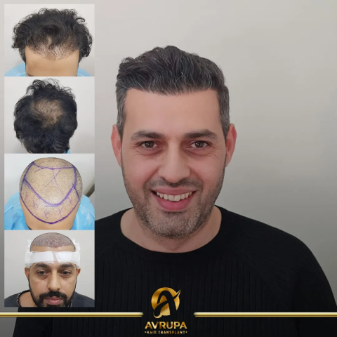 Avrupa Hair görseli