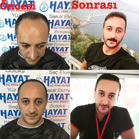 Batman Hayat Saç Ekim Merkezi görseli