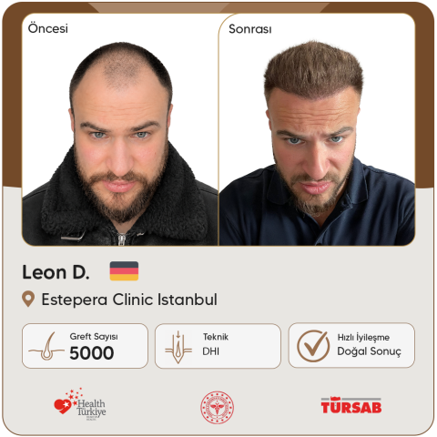 Estepera Saç Ekim görseli